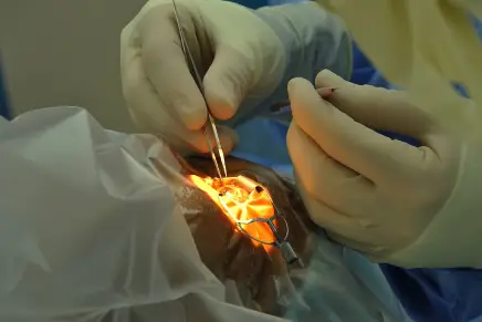 جراحی اب مروارید در اسلامشهر