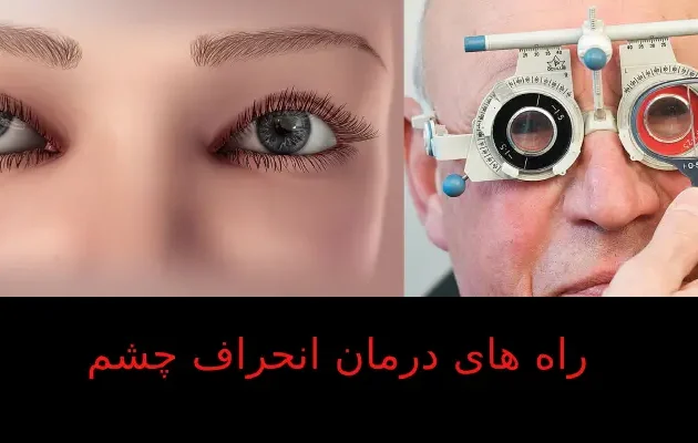 راه های درمان انحراف چشم