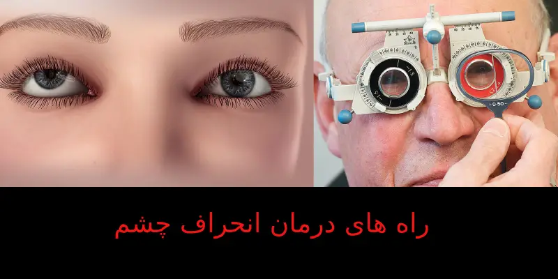 راه های درمان انحراف چشم