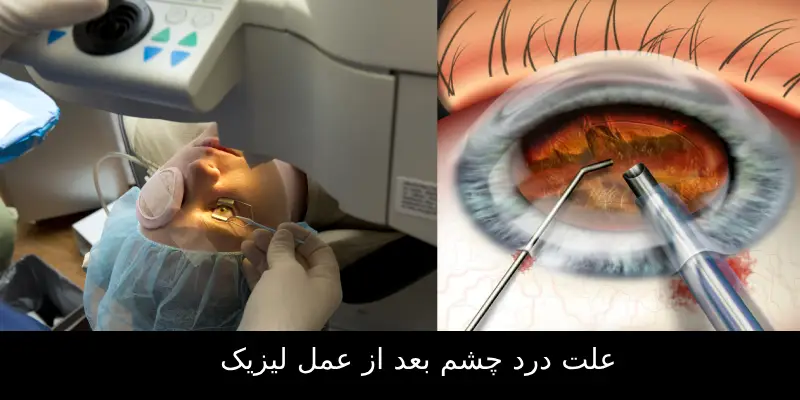 علت درد چشم بعد از عمل لیزیک