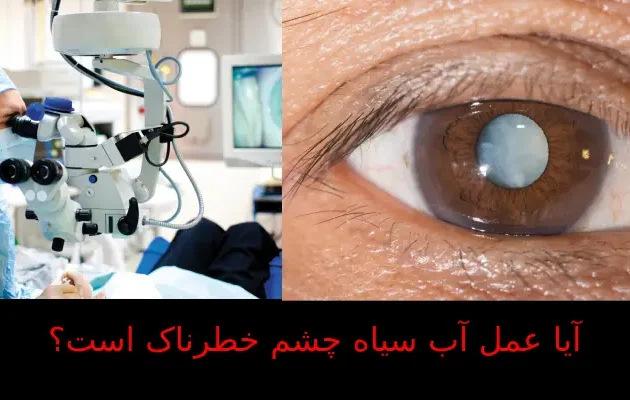 آیا عمل آب سیاه چشم خطرناک است؟