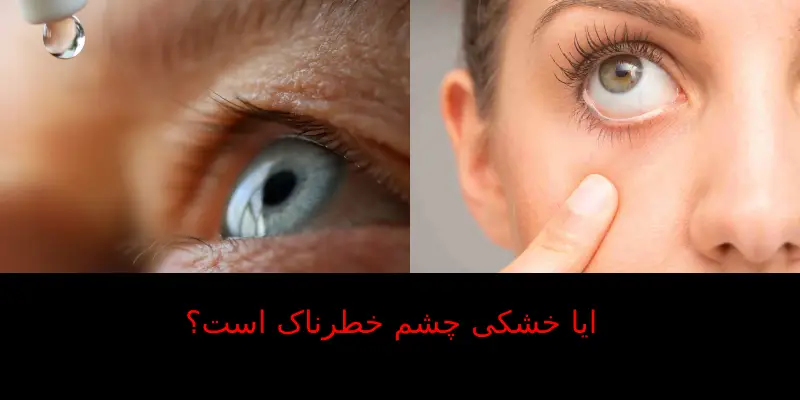 ایا خشکی چشم خطرناک است؟