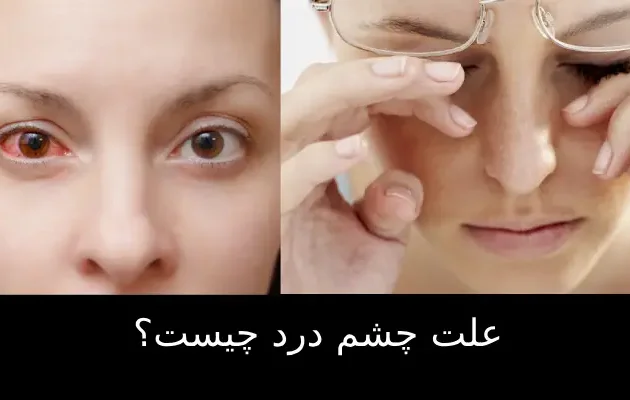 علت چشم درد چیست؟