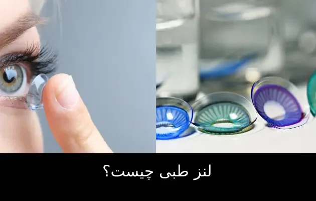 لنز طبی چیست؟
