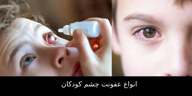 عفونت چشم کودکان