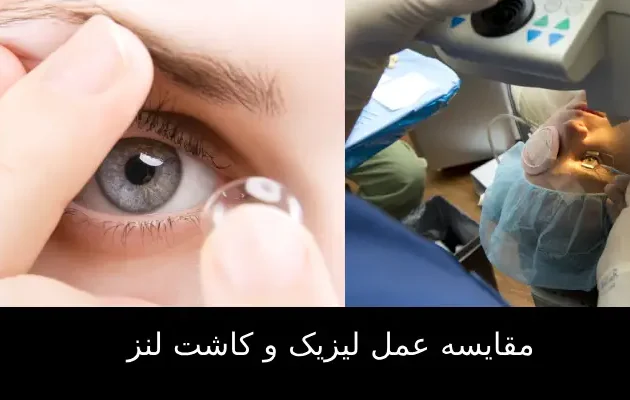 عمل لیزیک و کاشت لنز