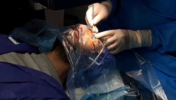 Eyelid surgery