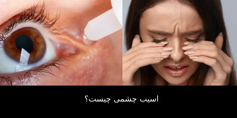 اسیب چشمی چیست؟